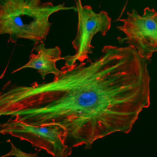 Células endoteliales con el núcleo teñido de azul por un marcador fluorescente que se une fuertemente a regiones enriquecidas en adenina y timina en secuencias de ADN